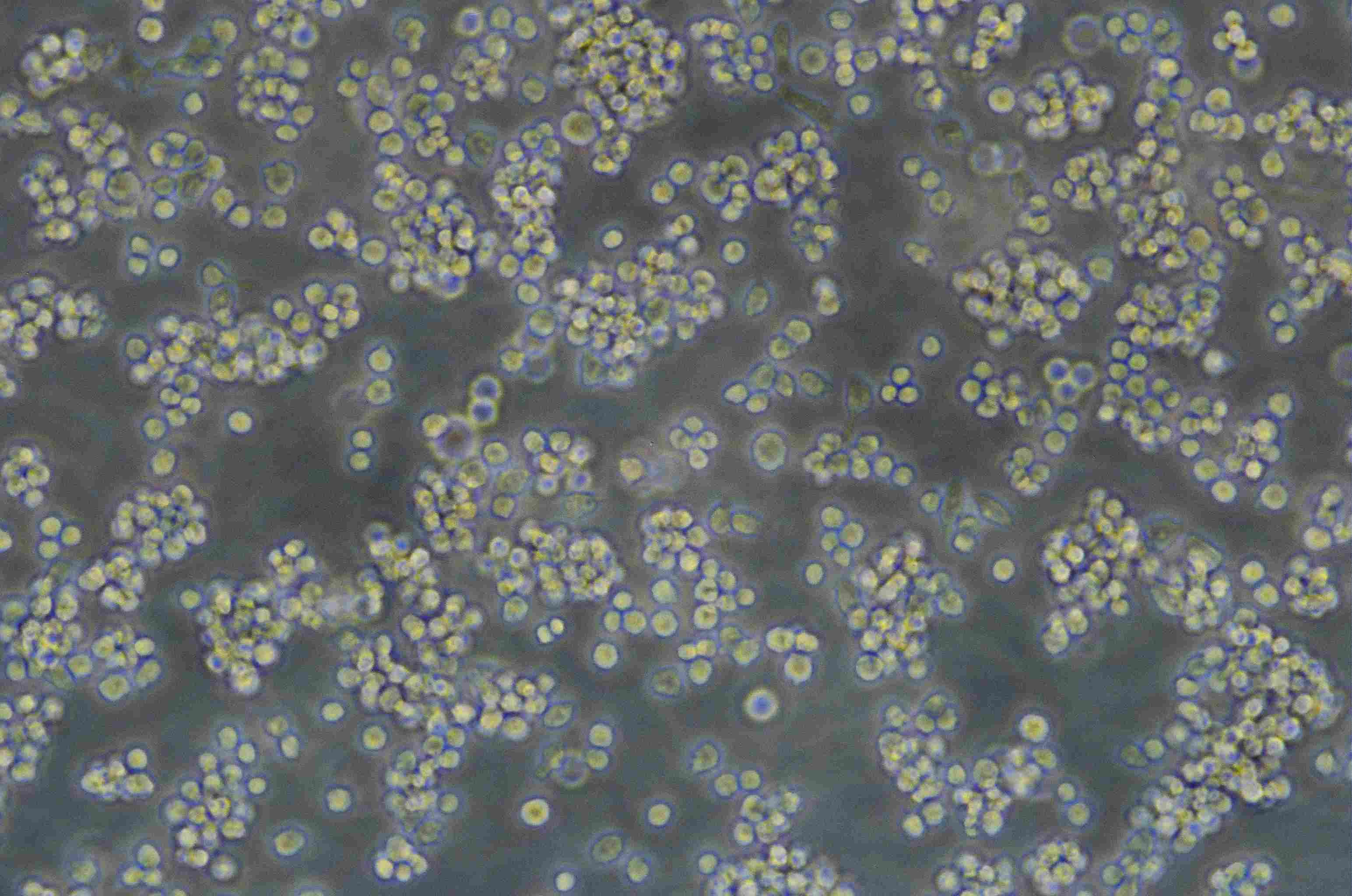 HuT 78 Cell:人T淋巴瘤细胞系