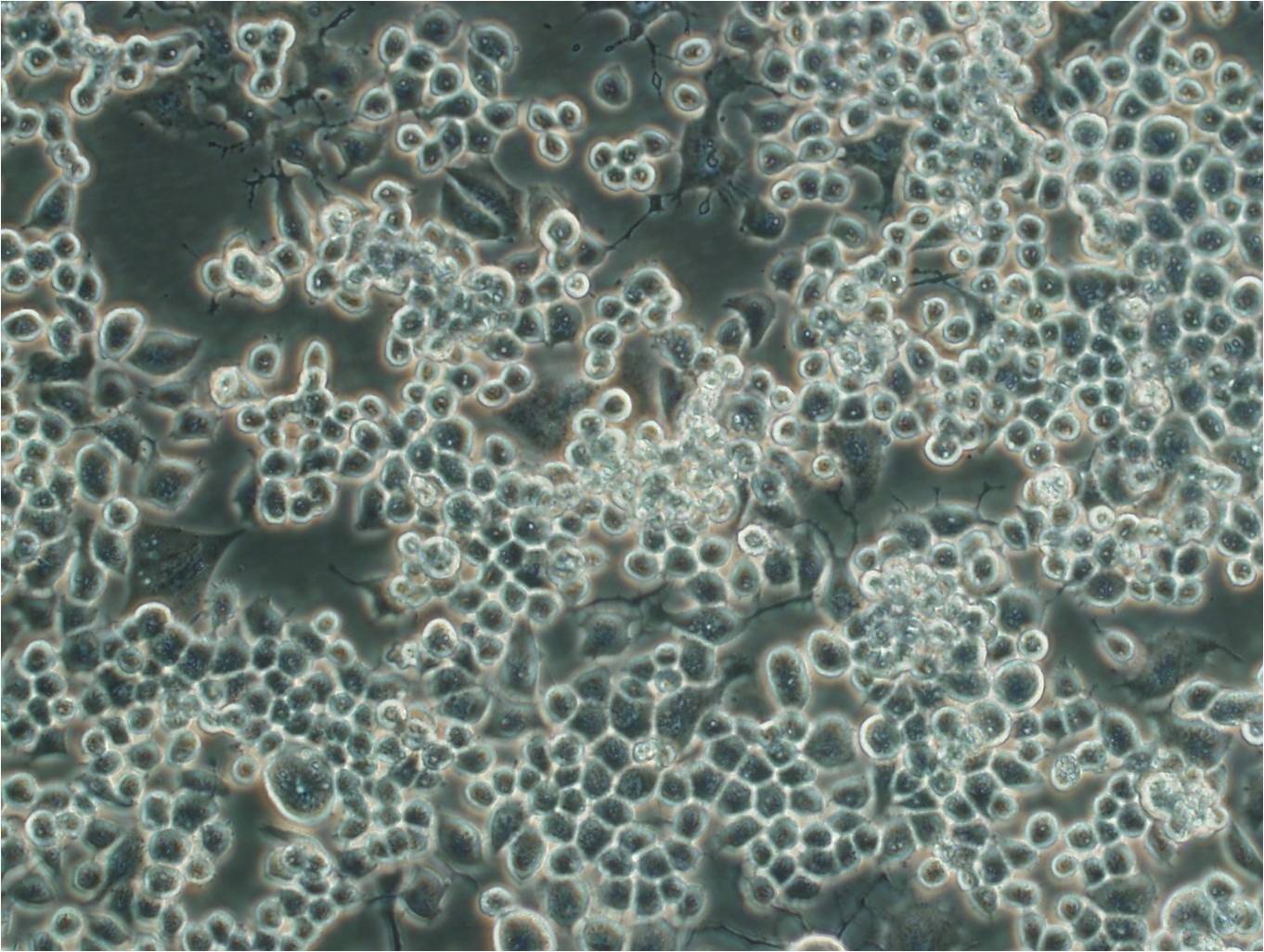 GI-1 epithelioid cells人神经胶质瘤和肉瘤细胞系