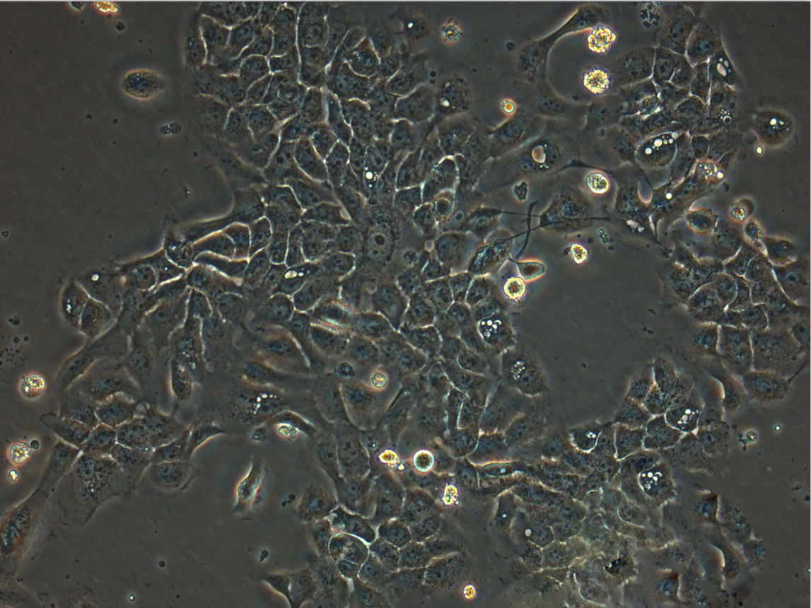 NCI-H1373 epithelioid cells人肺癌腺癌细胞系