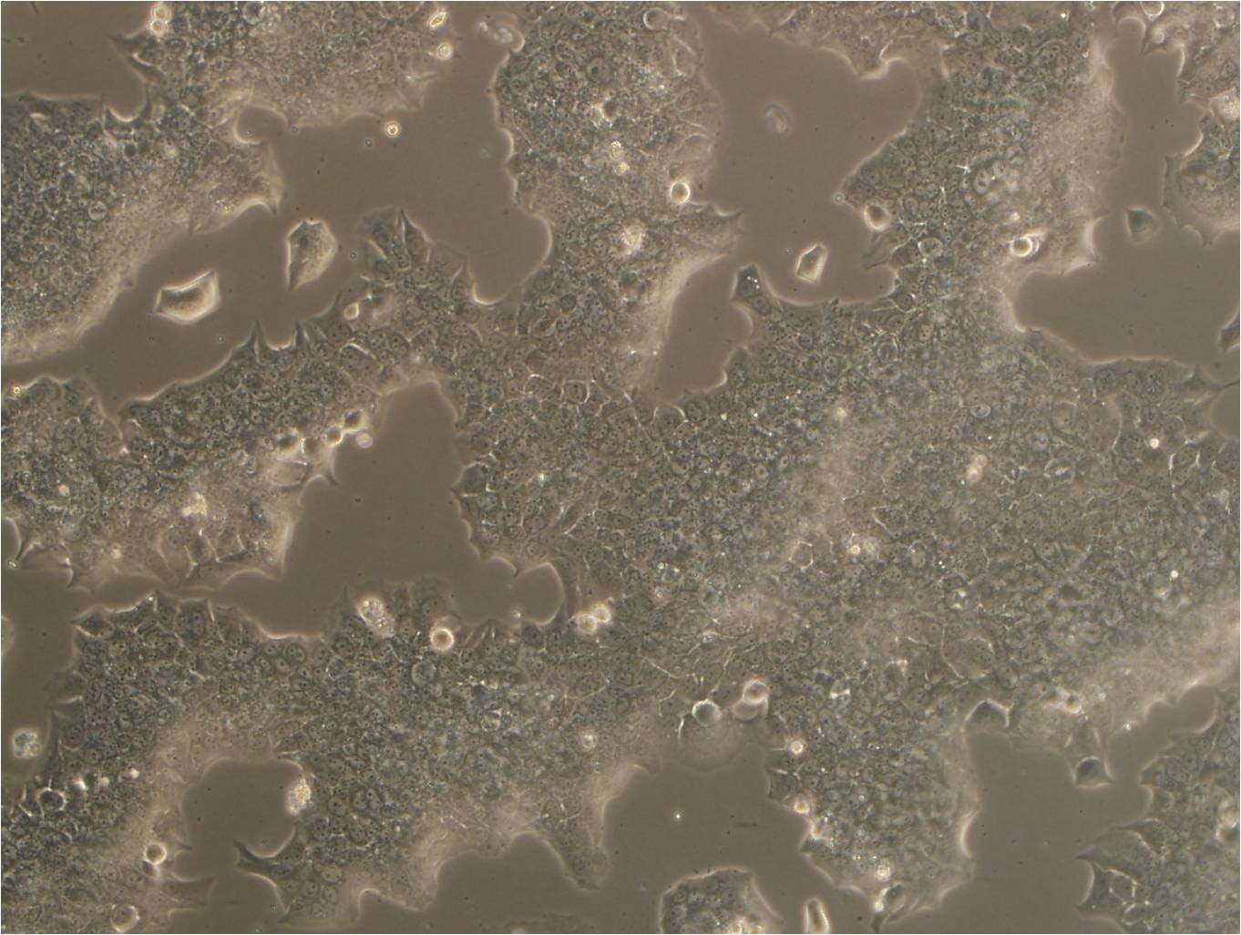 Caov-4 epithelioid cells人卵巢癌细胞系