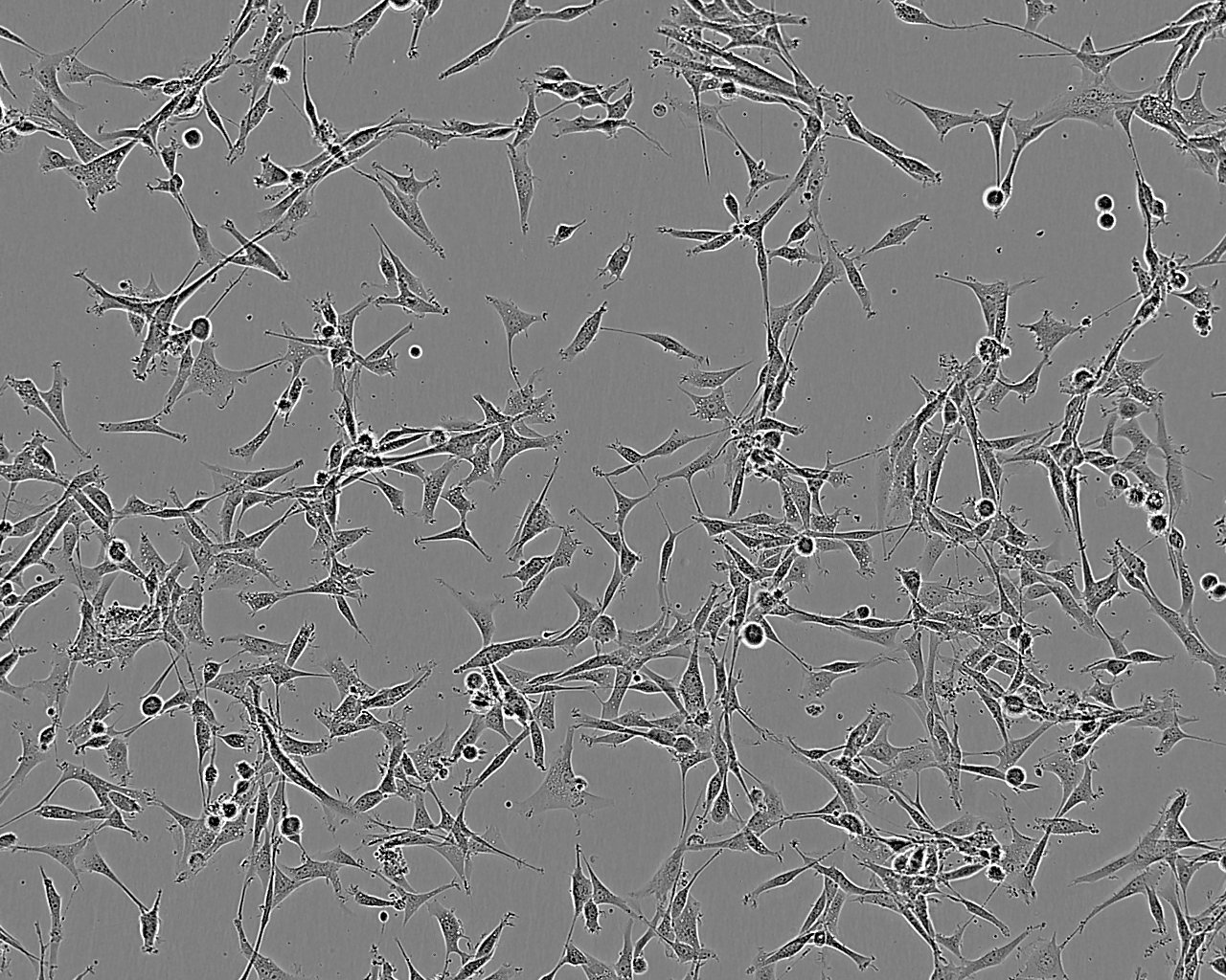 OE21 epithelioid cells人食道鳞状癌细胞系