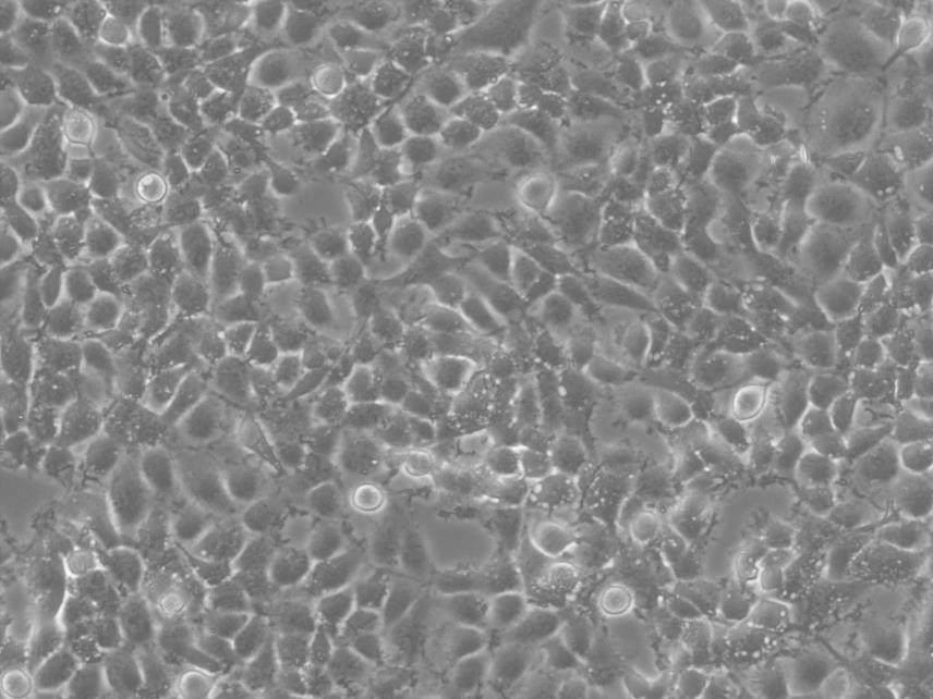 SCC-25 epithelioid cells人口腔鳞癌细胞系