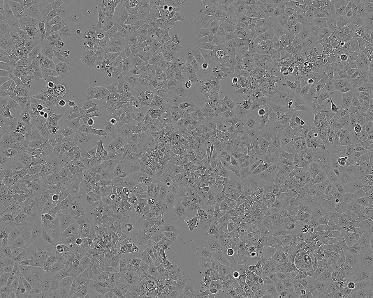 Onda 11 epithelioid cells人脑神经胶质瘤细胞系