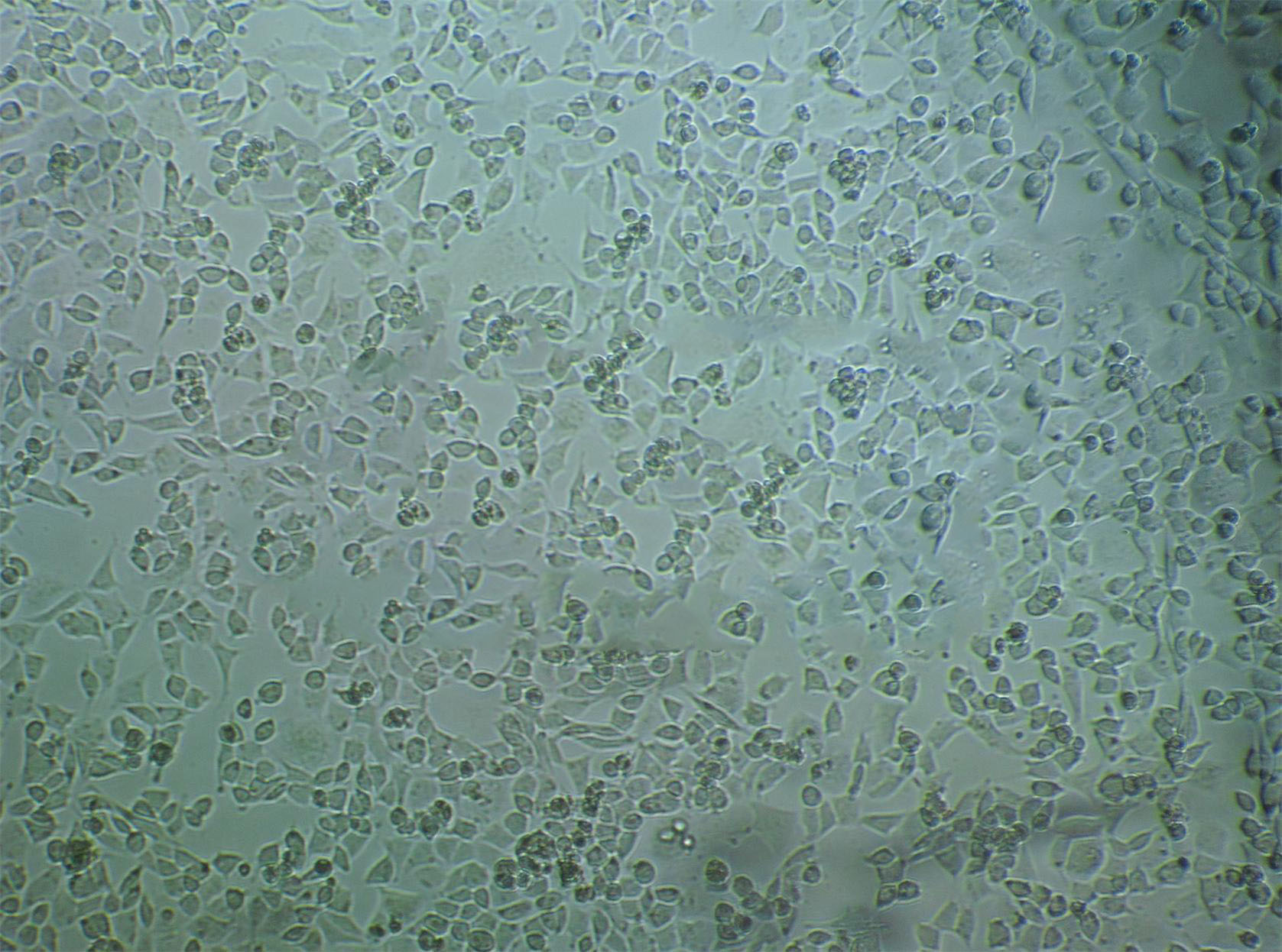 SKG-IIIa epithelioid cells人宫颈癌细胞系