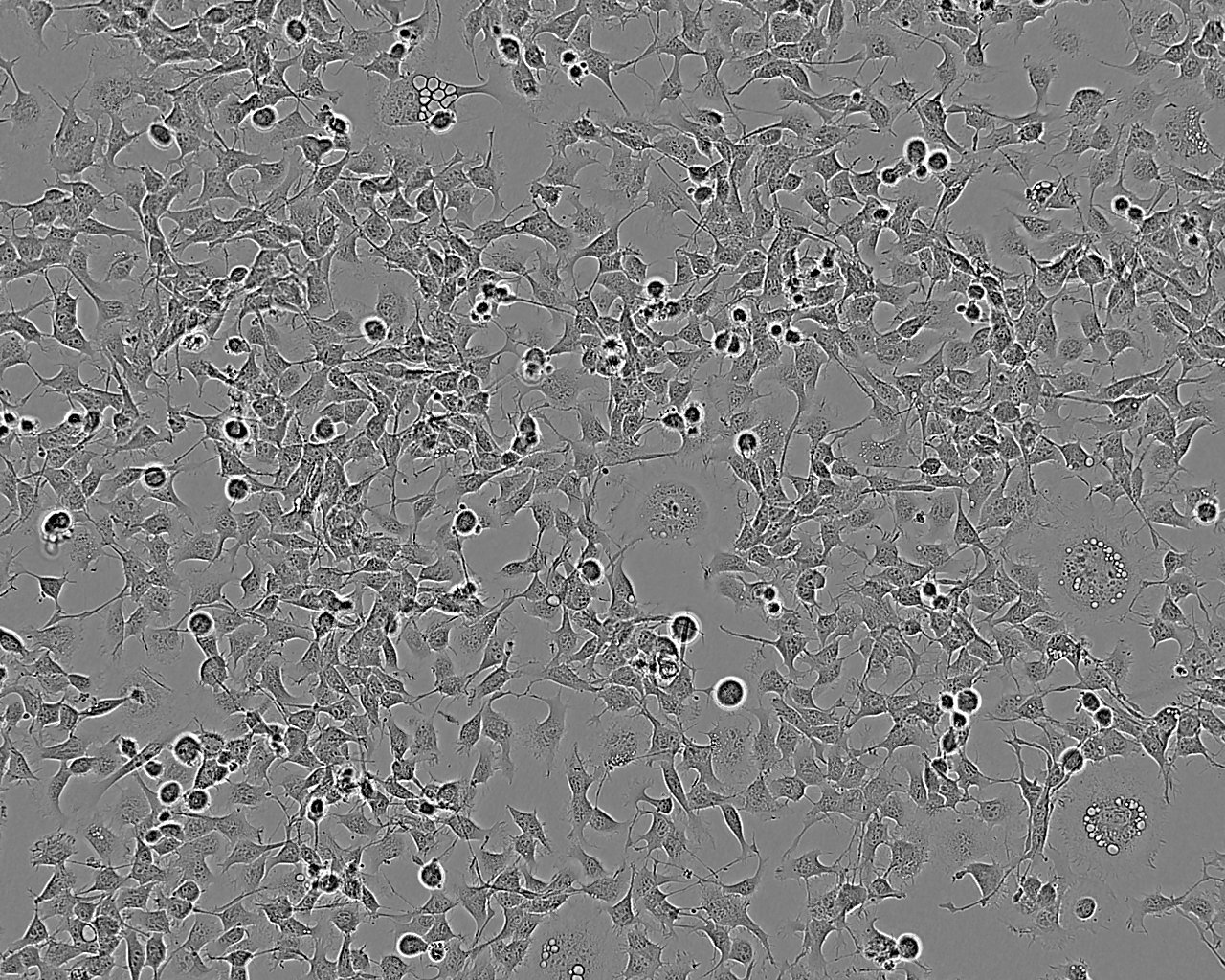 SNB-19 epithelioid cells人胶质瘤细胞系