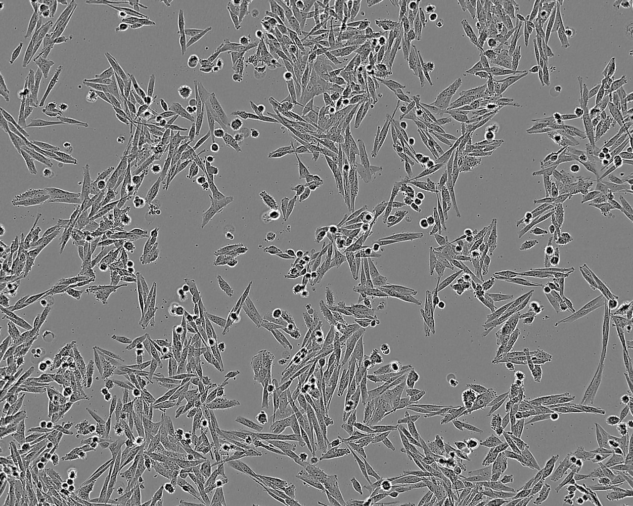 SW1353 epithelioid cells人软骨肉瘤细胞系