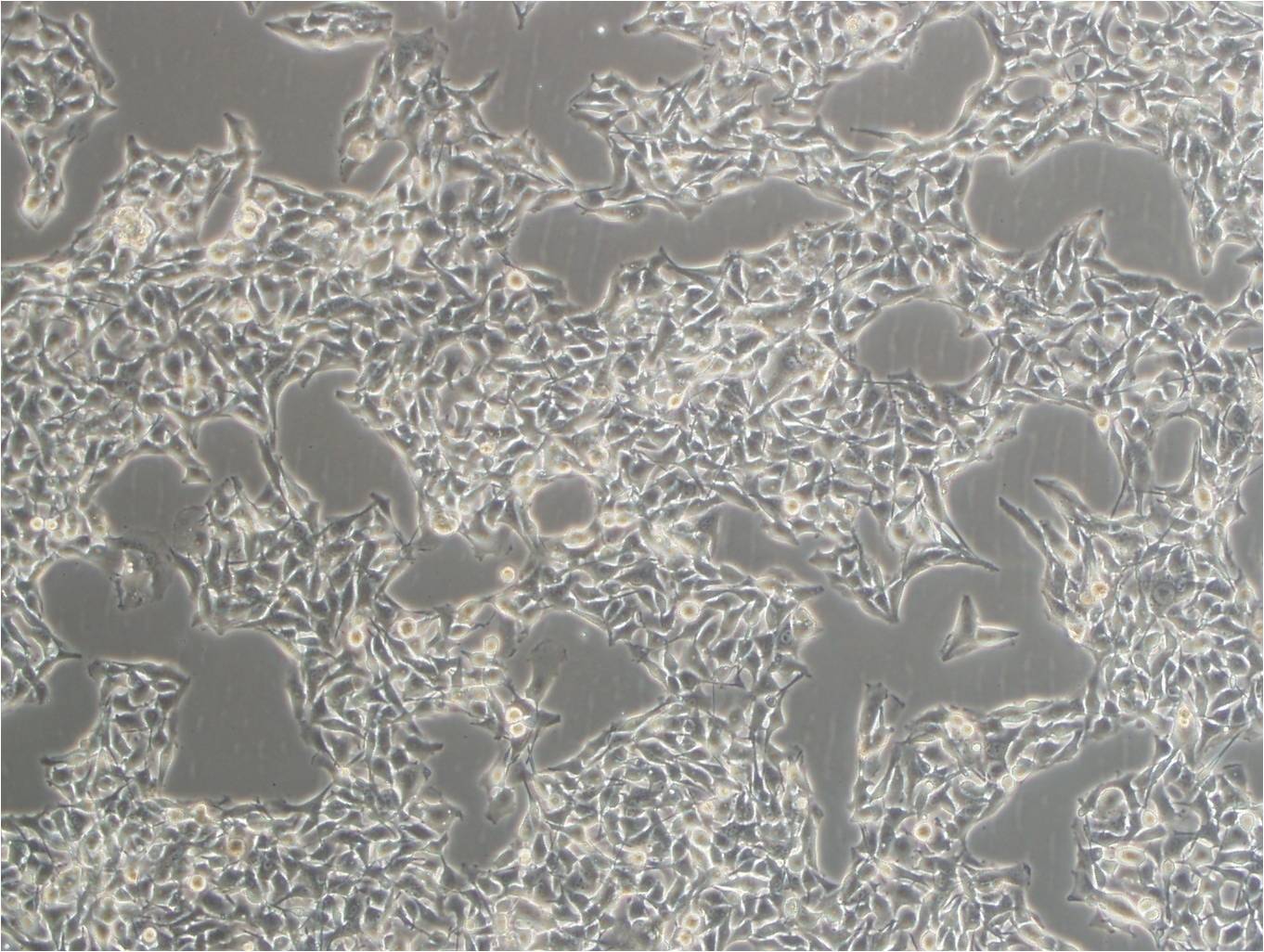 M619 epithelioid cells人侵袭性脉络膜黑色素瘤细胞系