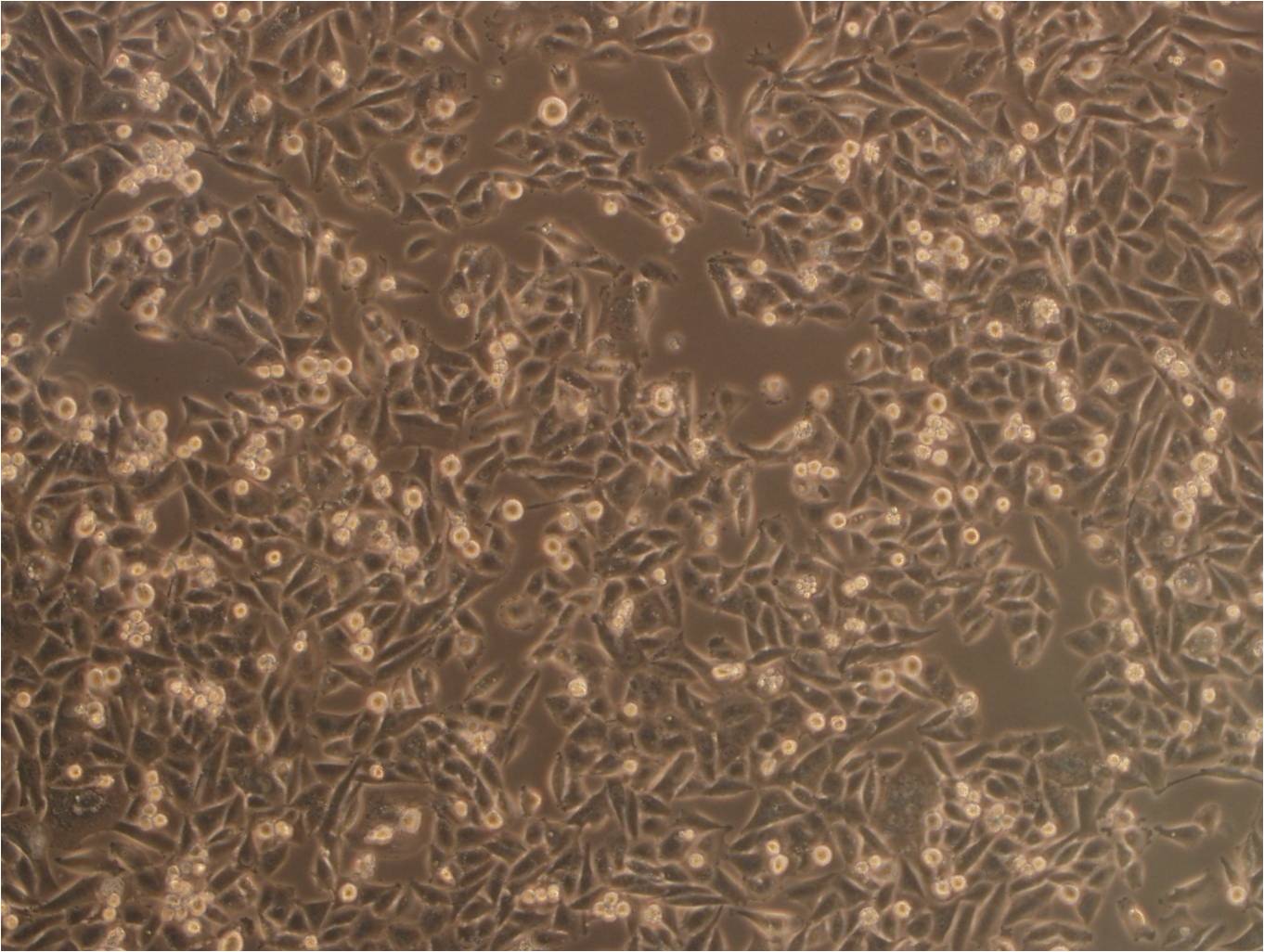 HuLEC-5a epithelioid cells人肺微血管内皮细胞系