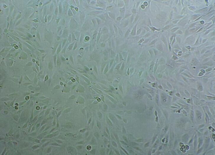 NCI-H125 epithelioid cells人非小细胞肺癌细胞系