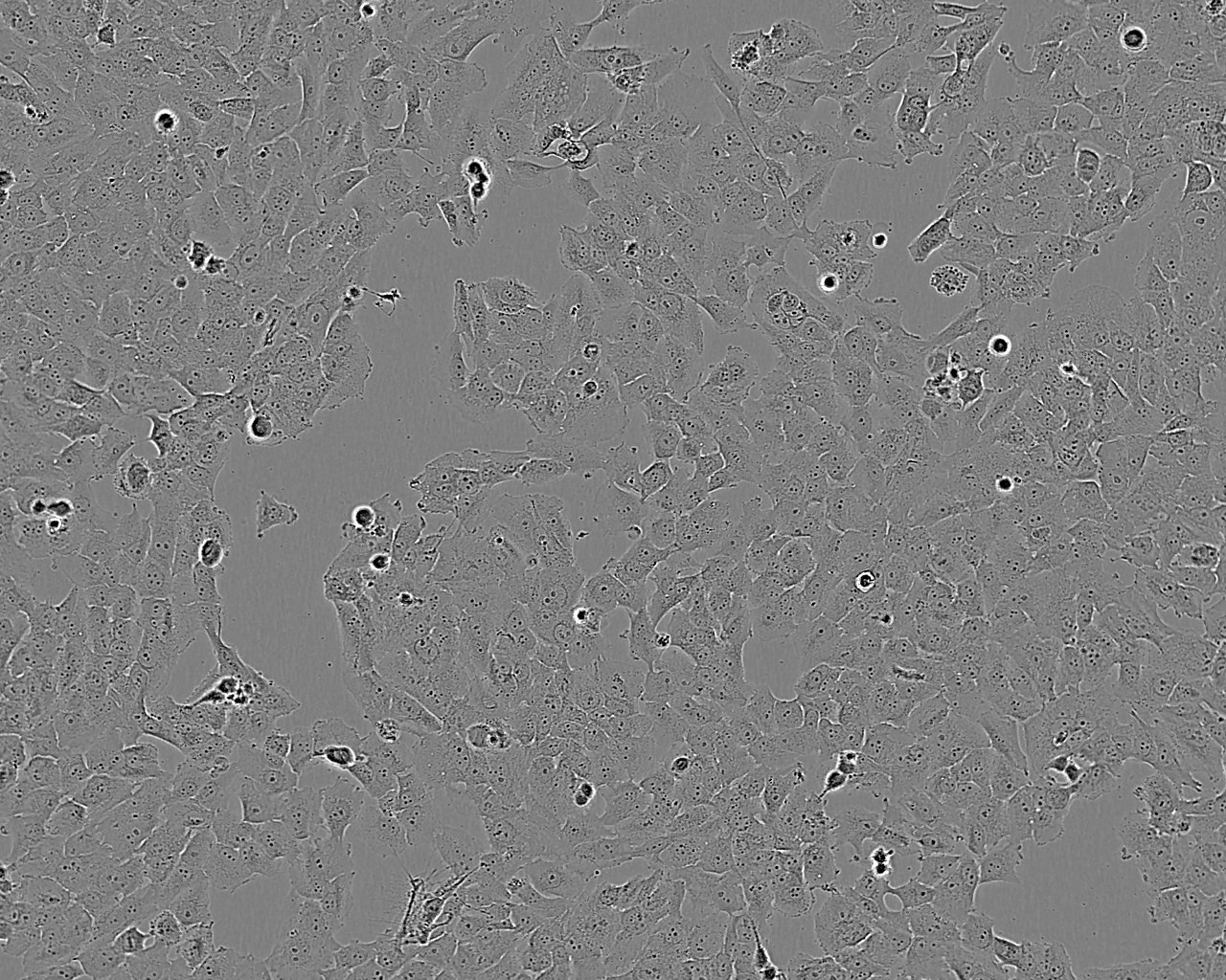 WM115 epithelioid cells人黑色素瘤细胞系