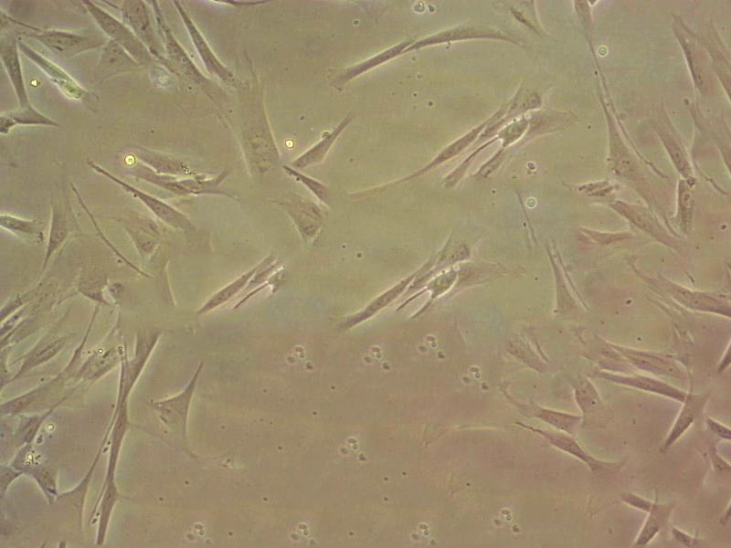 CCD-19Lu fibroblast cells人肺成纤维细胞系