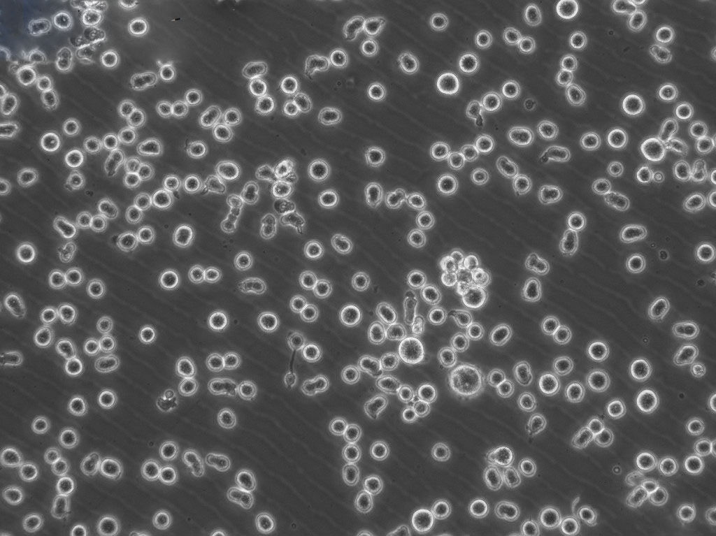 MJ Lymphoblastoid cells人皮肤T淋巴细胞瘤细胞系