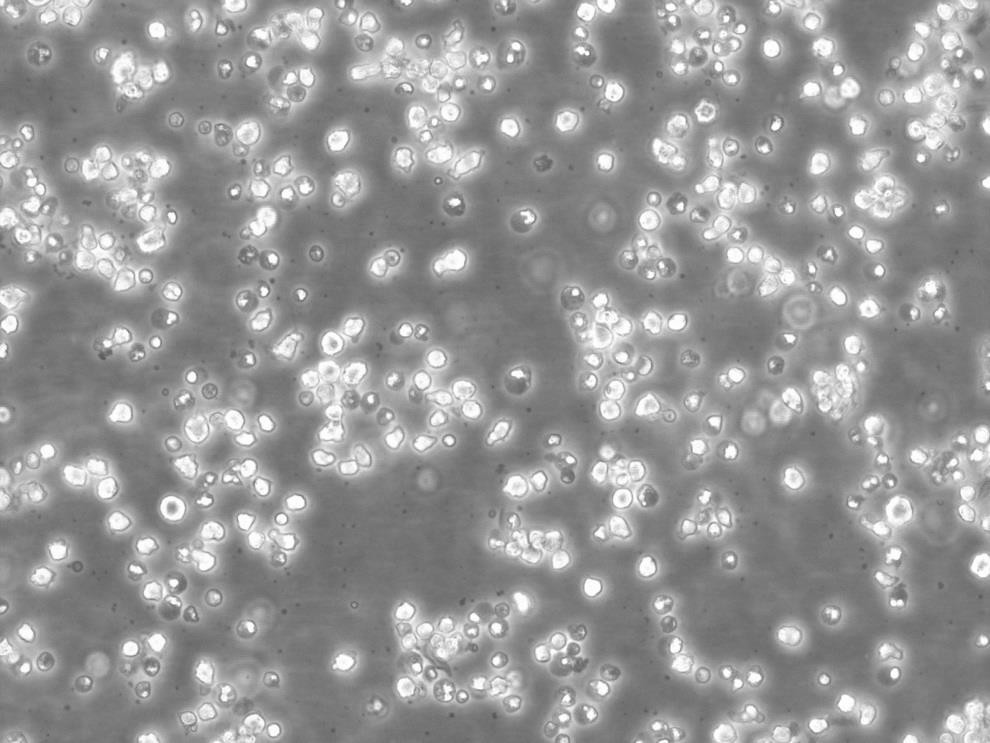 P31/FUJ Lymphoblastoid cells人急性单核白血病细胞系