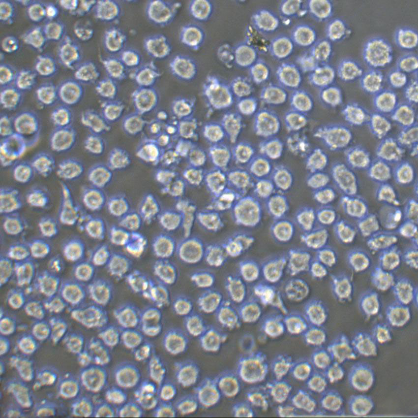 CEMO-1 Lymphoblastoid cells人急性B淋巴细胞白血病细胞系