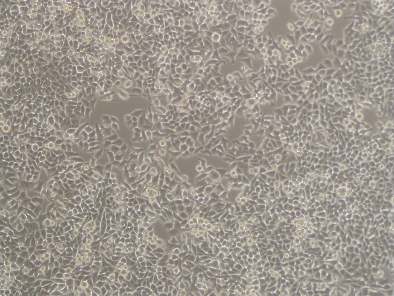 NPA epithelioid cells人甲状腺乳头状癌细胞系