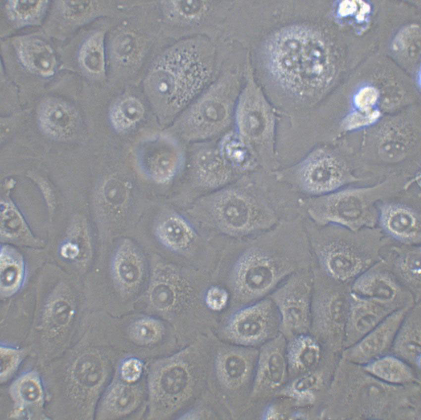 NCI-H1694 Adherent人小细胞肺癌细胞系