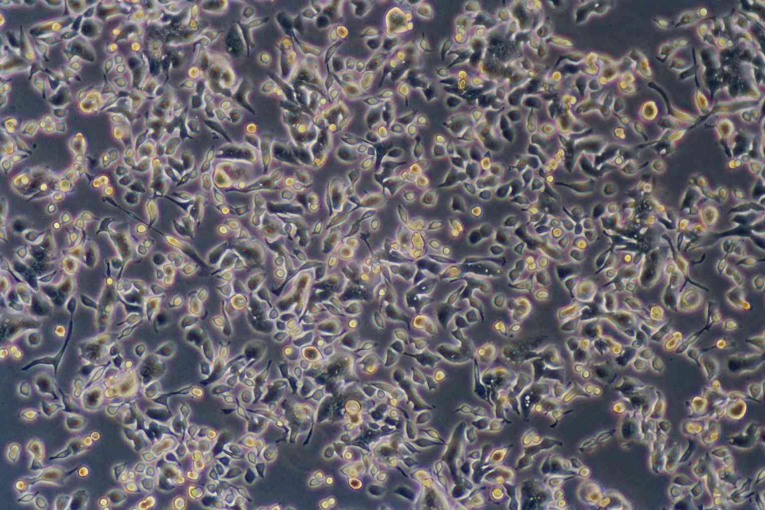 LS180 epithelioid cells人结肠腺癌细胞系