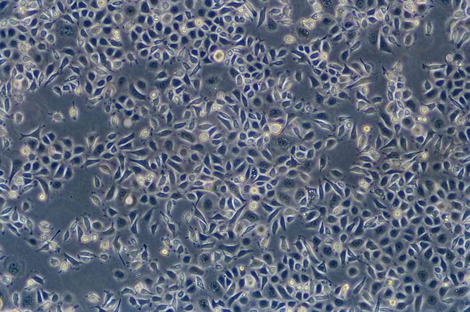 MDST8 epithelioid cells人结肠癌细胞系