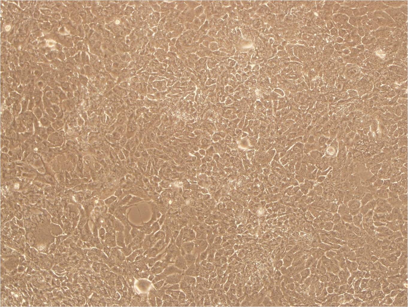 CT26 epithelioid cells小鼠结肠癌细胞系