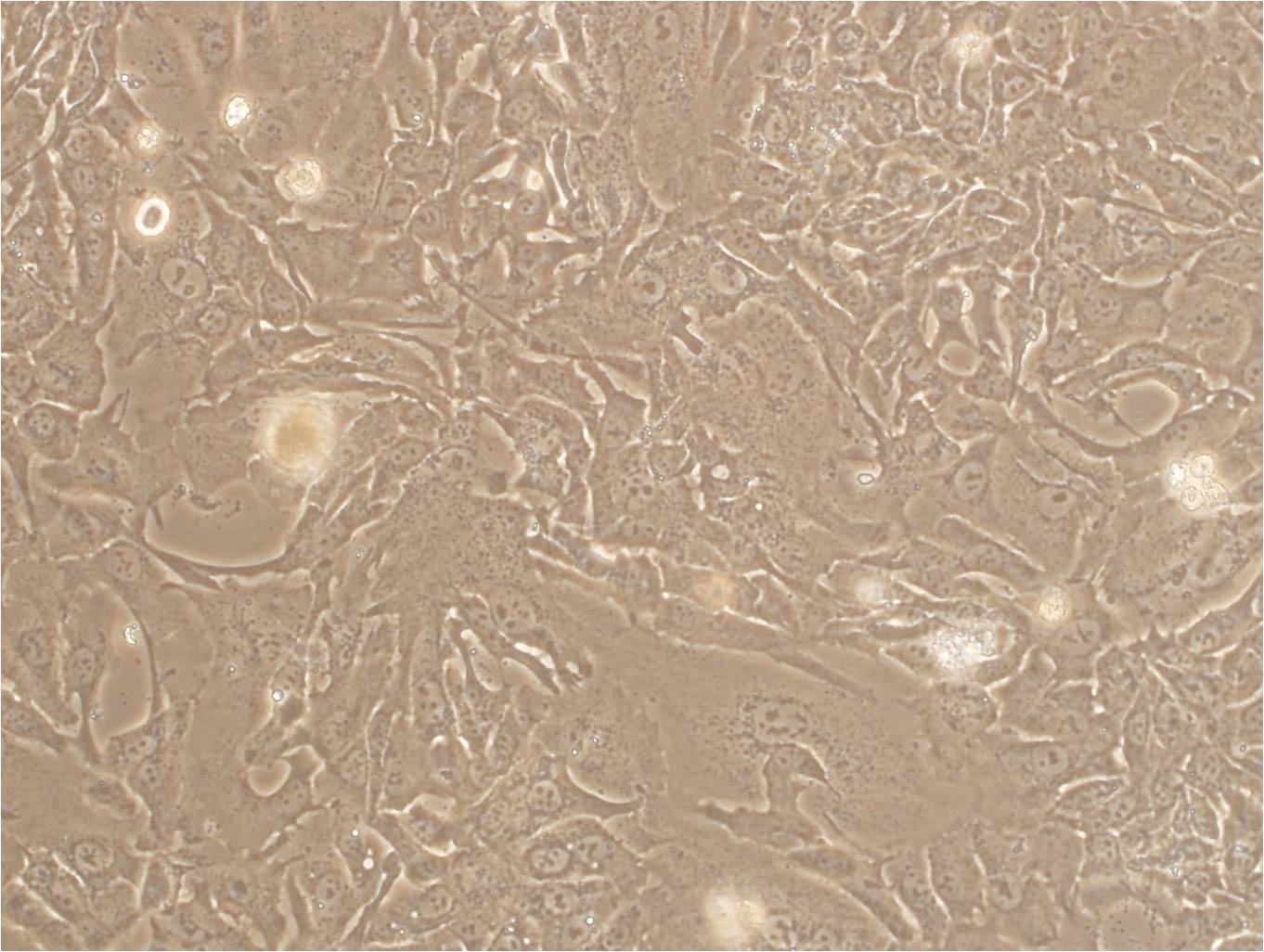 NW38 epithelioid cells人黑色素瘤细胞系