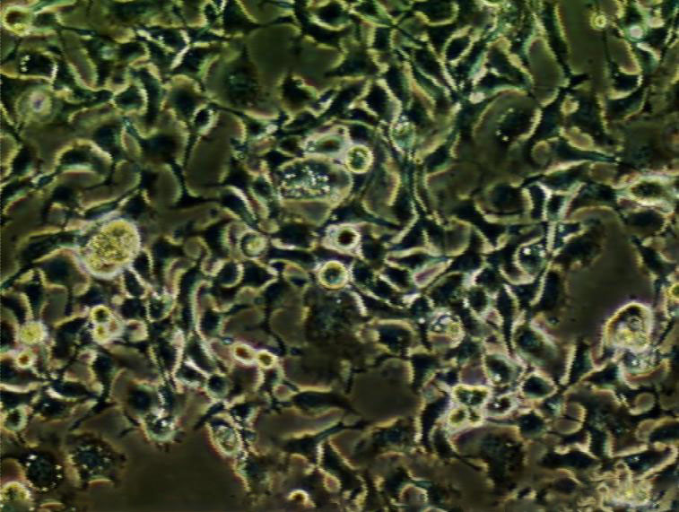 COR-L26 epithelioid cells人肺癌细胞系