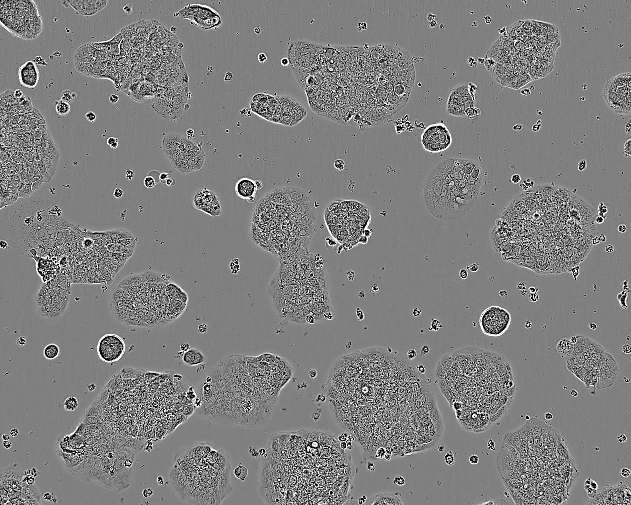 HARA-B epithelioid cells人肺癌鳞癌细胞系