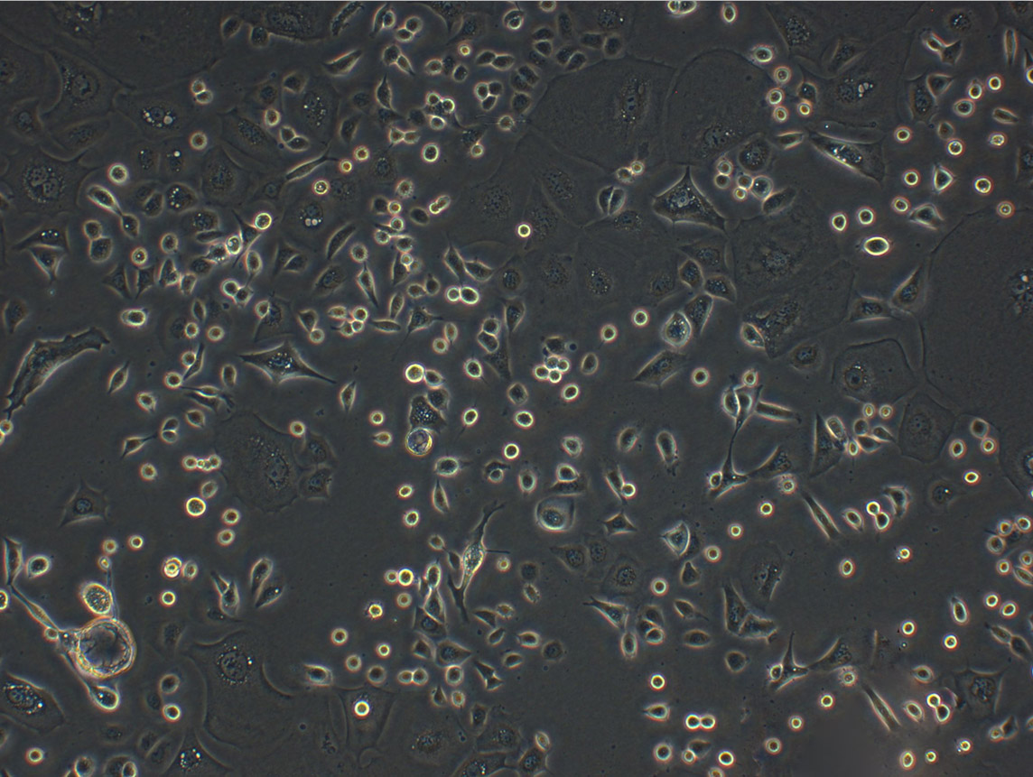 LUDLU-1 epithelioid cells人肺癌鳞癌细胞系