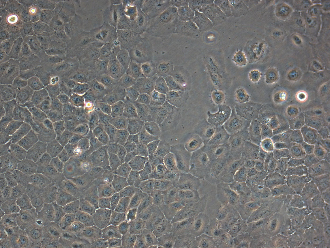 SNU-601 epithelioid cells人胃癌细胞系