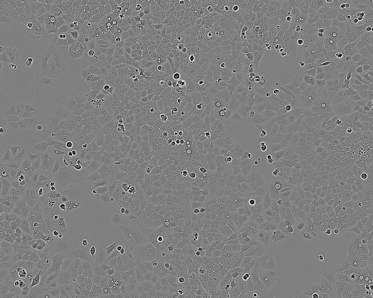 UPCI-SCC-090 Adherent人口腔鳞癌细胞系