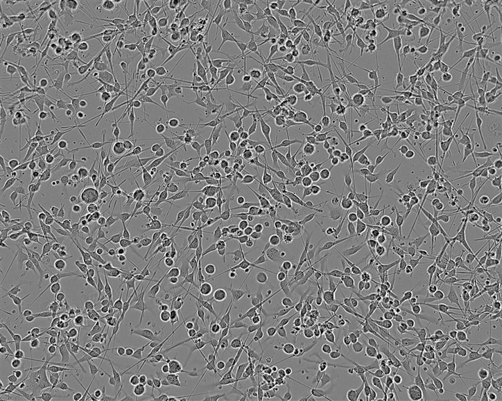 GC9811-P Adherent人胃癌腹膜高转移细胞系