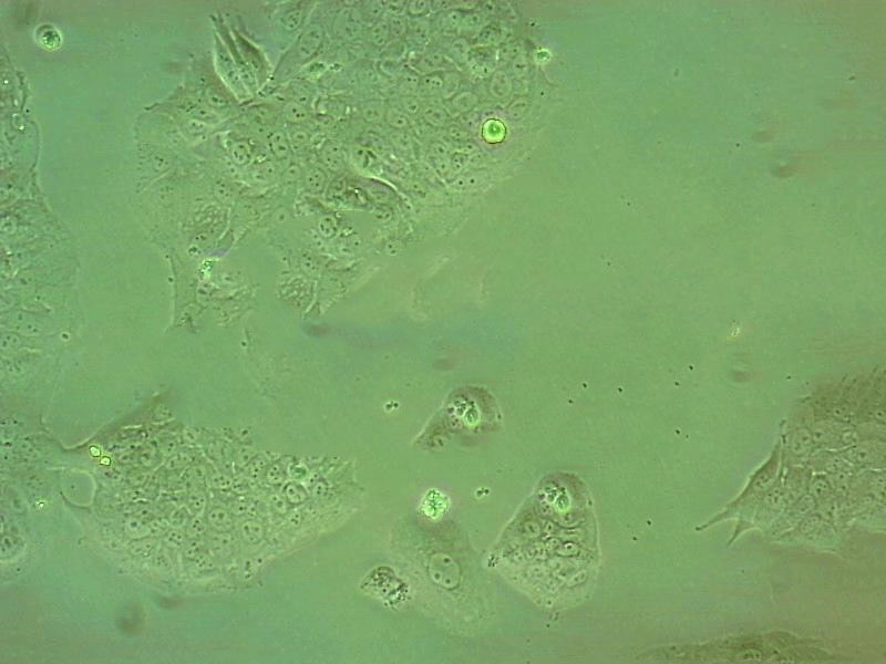 253J-BV Adherent人膀胱癌细胞系