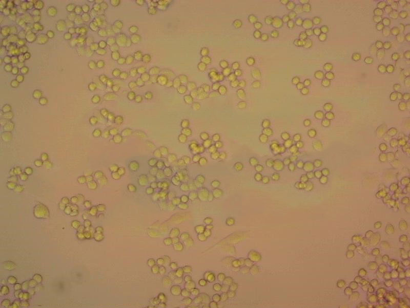 ME-1 [Human leukemia] Suspended人类急性髓系白血病细胞系