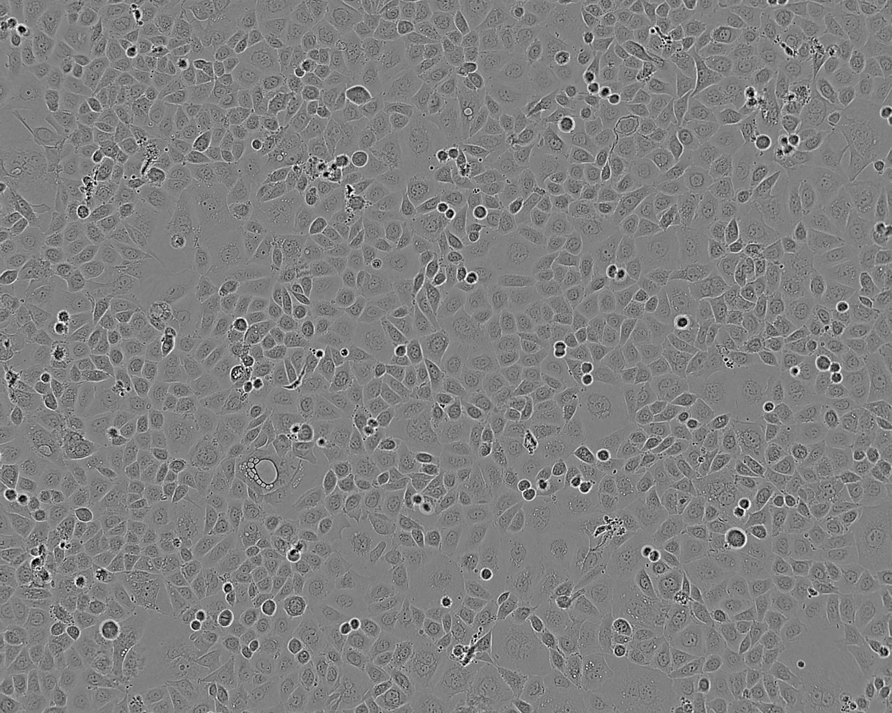 HCC2218 Thawing人乳腺导管癌细胞系