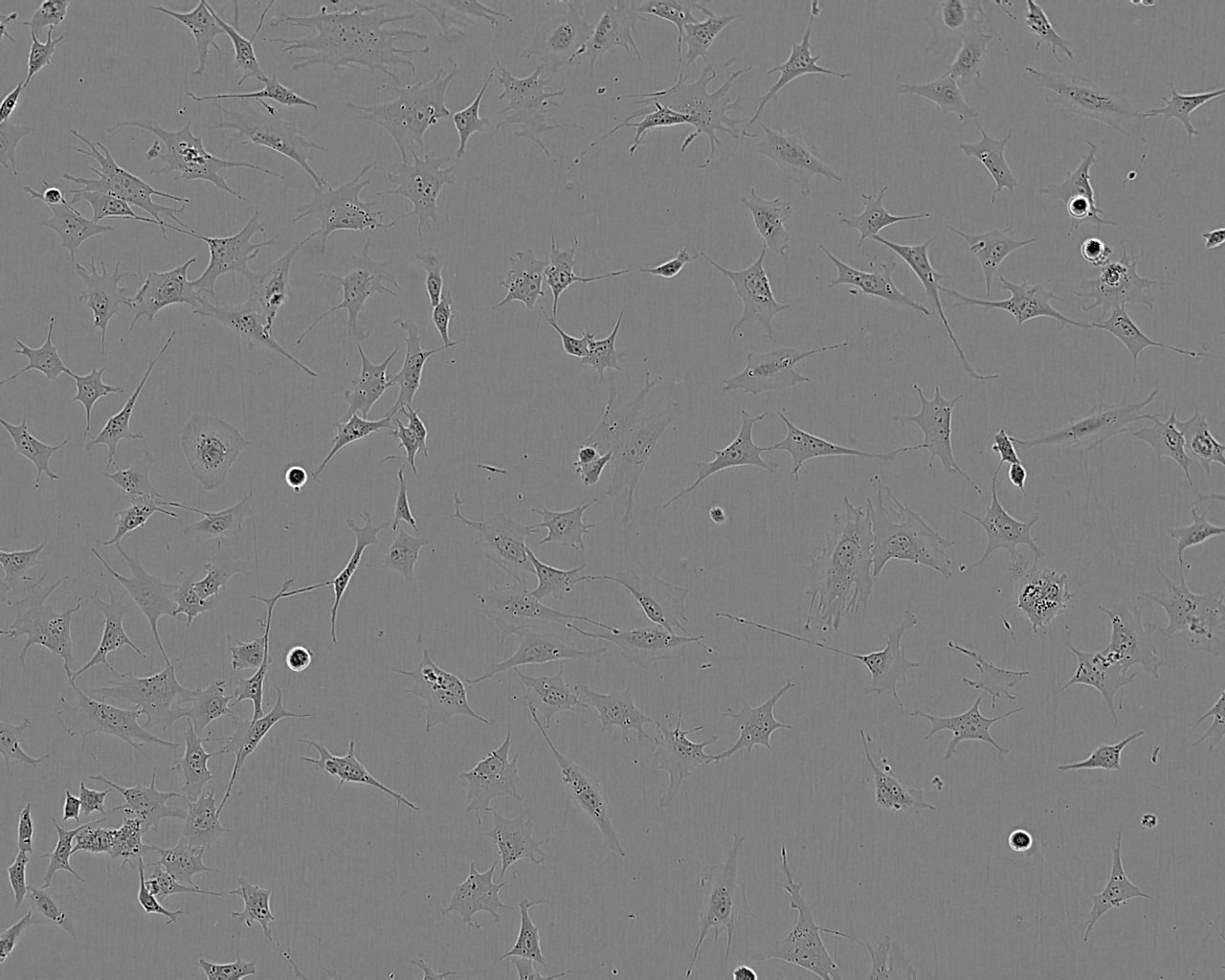 NCI-H2195 epithelioid cells人肺癌细胞系