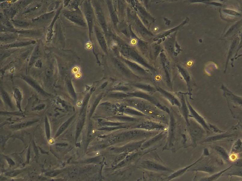 NCI-H716 cell line人结直肠腺癌细胞系