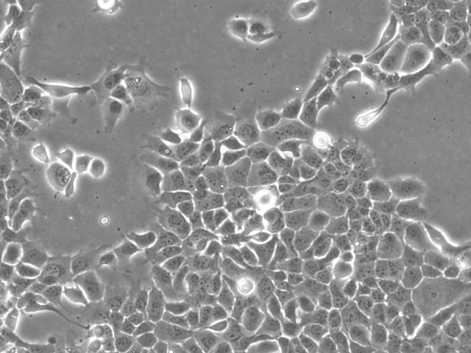 BCaP-37 cell line人乳腺癌细胞系