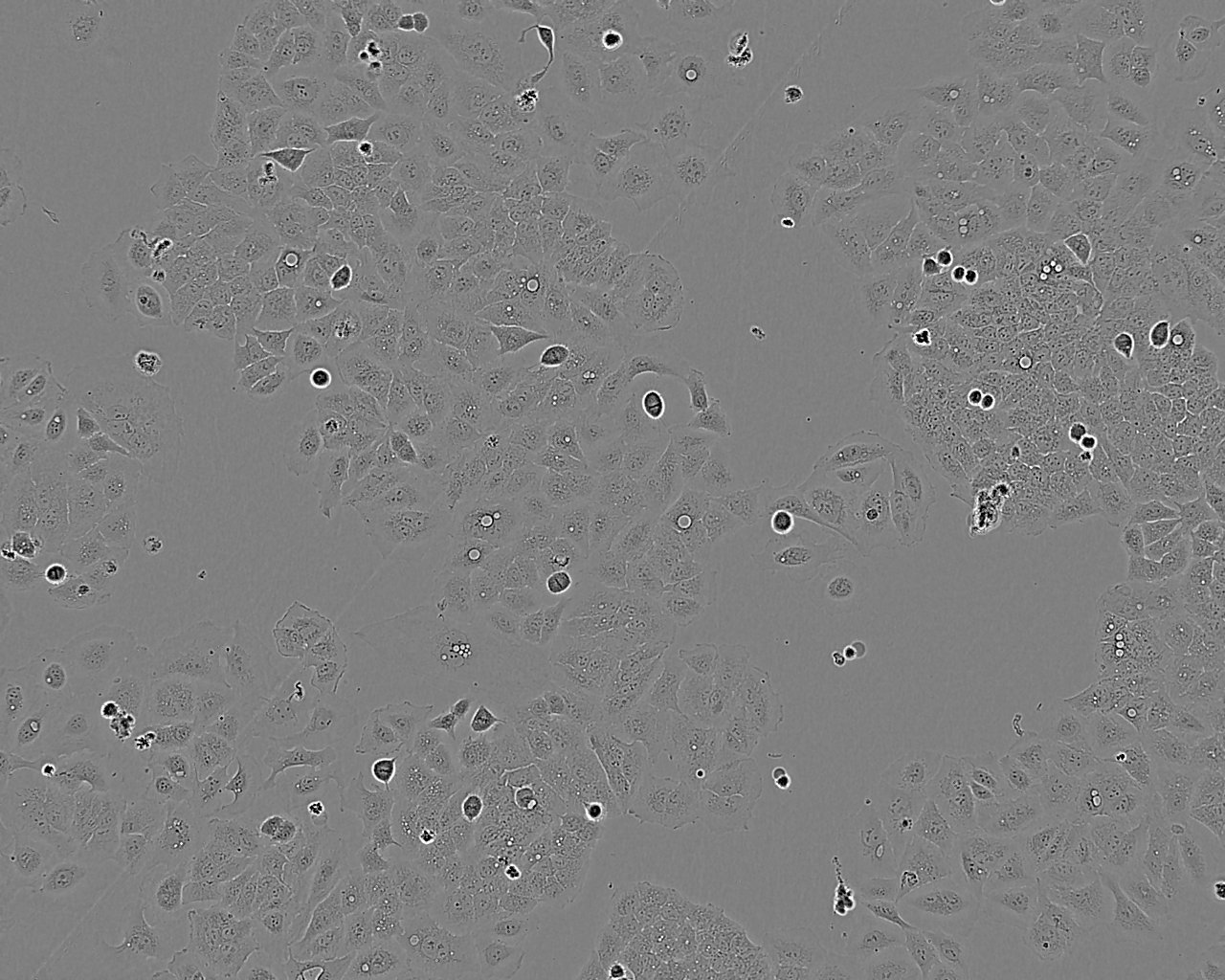 hEM15A Thawing人永生化子宫内膜异位症患者在位内膜间质细胞系