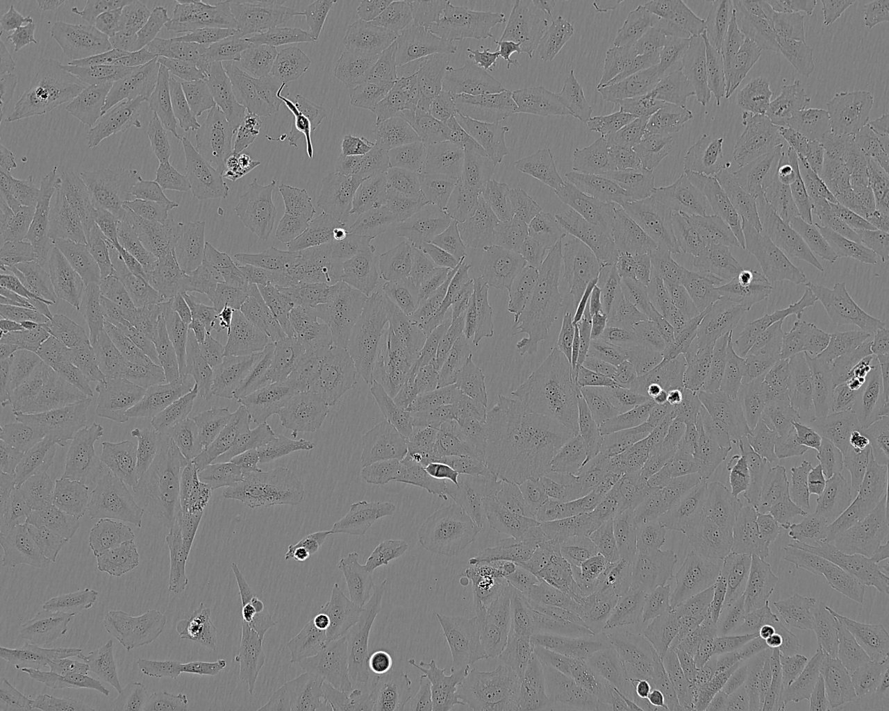 HCC1008 Thawing人乳腺导管癌细胞系