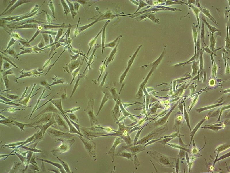 MS751 cell line人子宫颈表皮癌细胞系