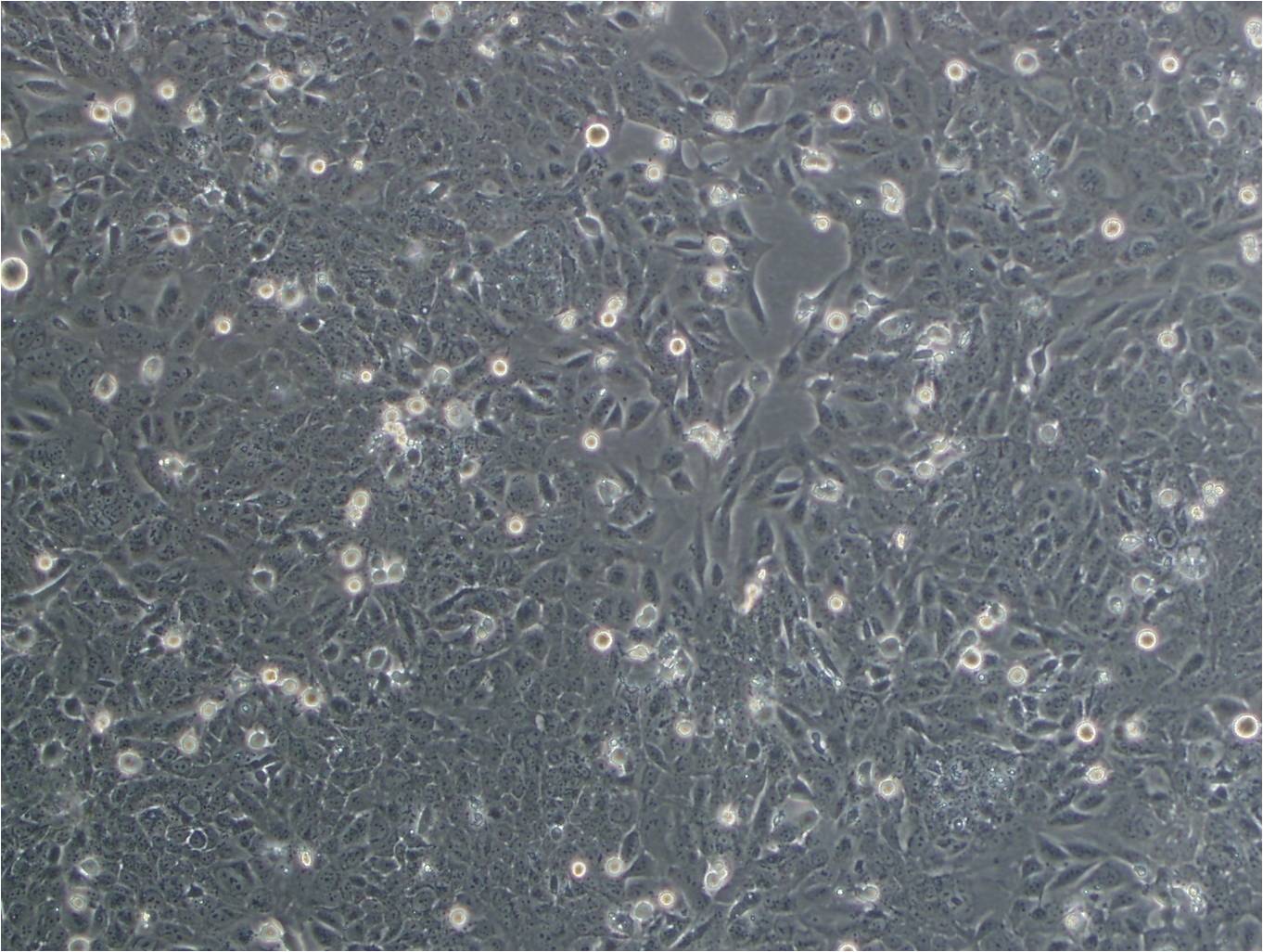 HCC1395 cell line人乳腺导管癌细胞系