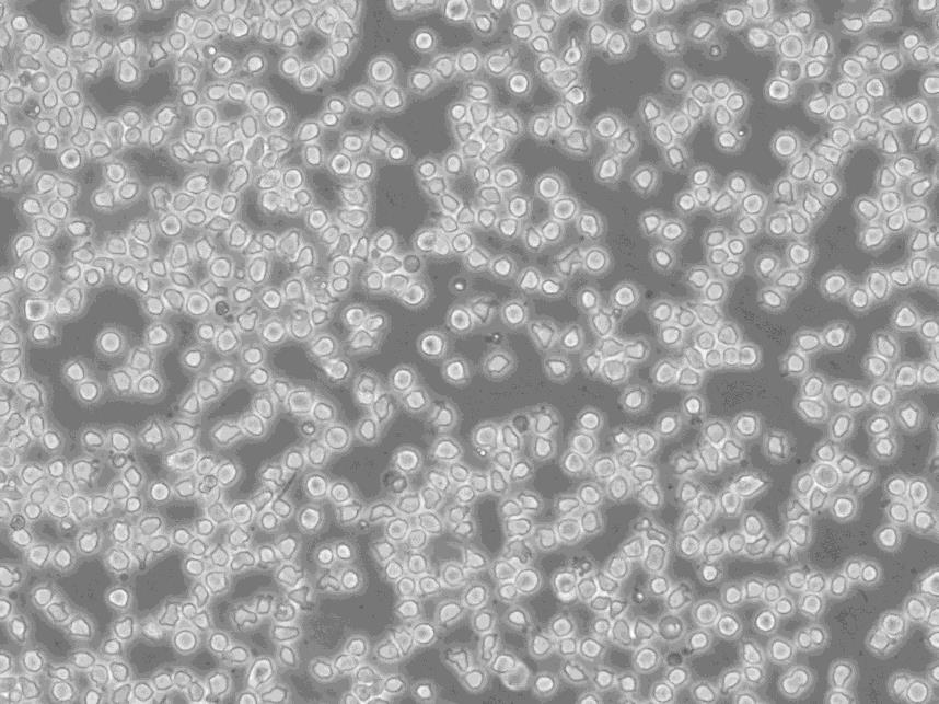 OCI-AML-4 Thawing人急性髓系白血病细胞系