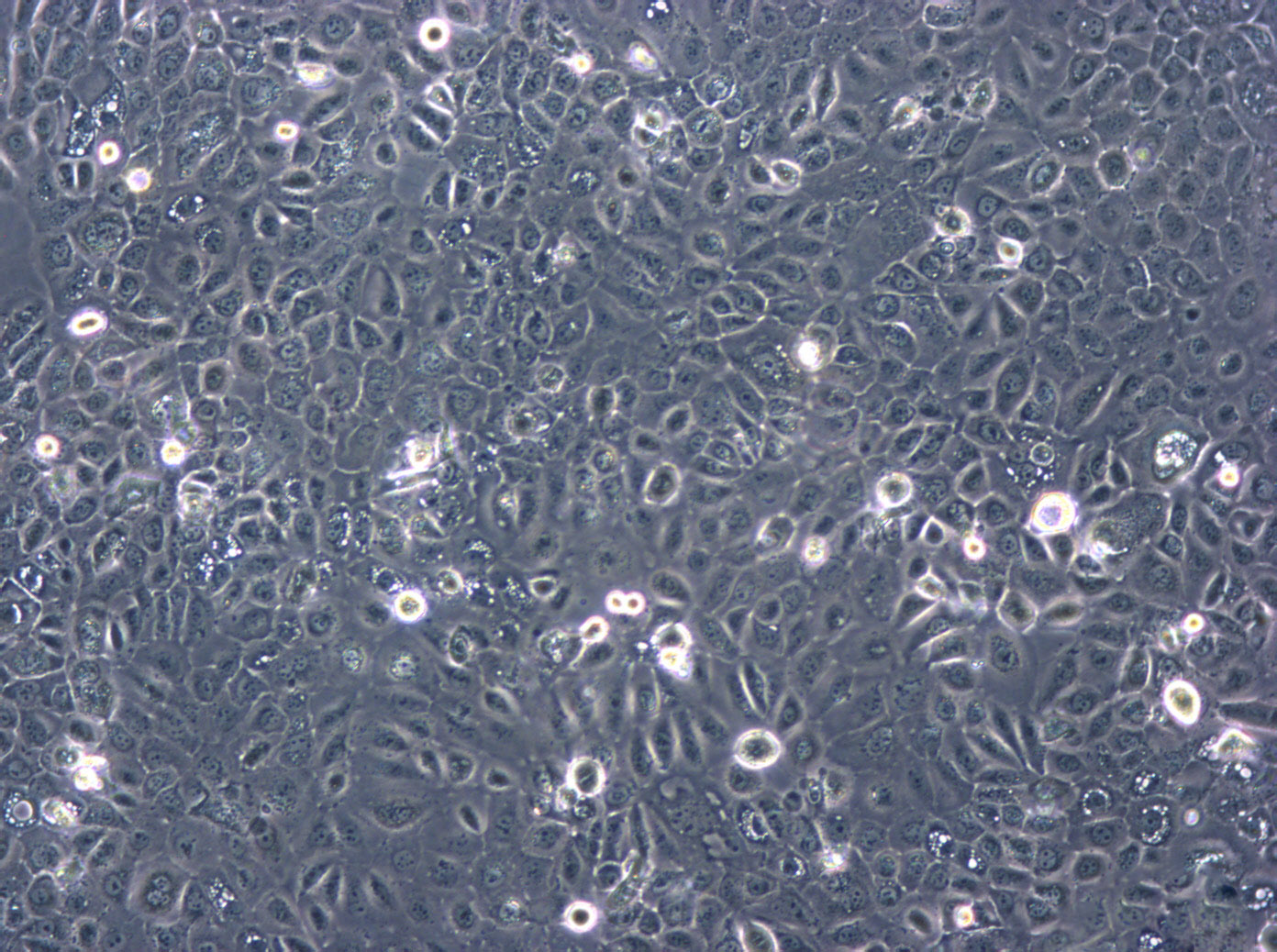 PG-BE1 cell line人肺巨细胞癌高转移细胞系