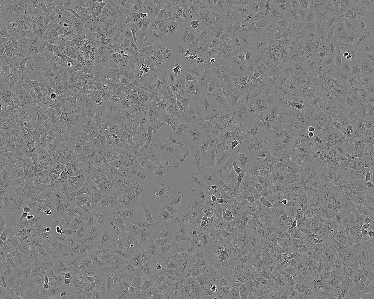 HT115 cell line人结肠癌细胞系