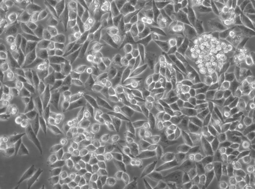 NCI-H2171 cell line人小细胞肺癌细胞系