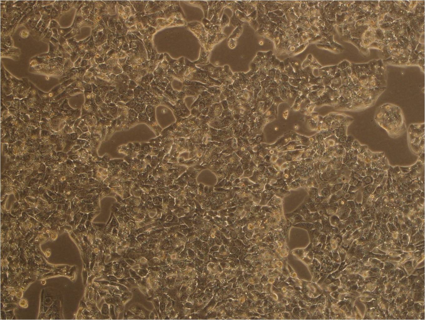 NCI-H209 cell line人小细胞肺癌细胞系