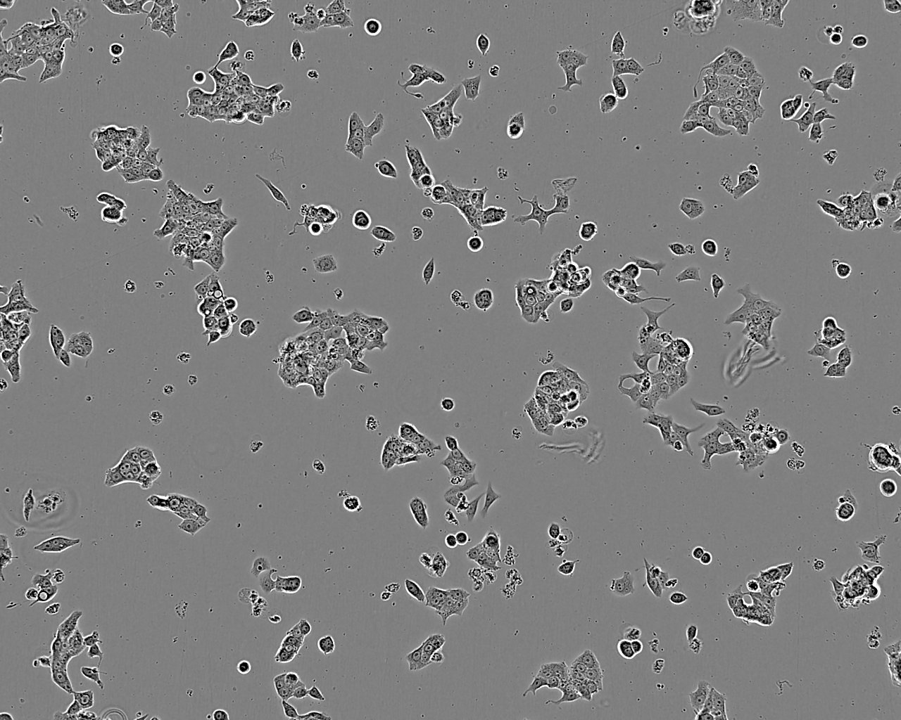 OVCA432 cell line人卵巢癌细胞系