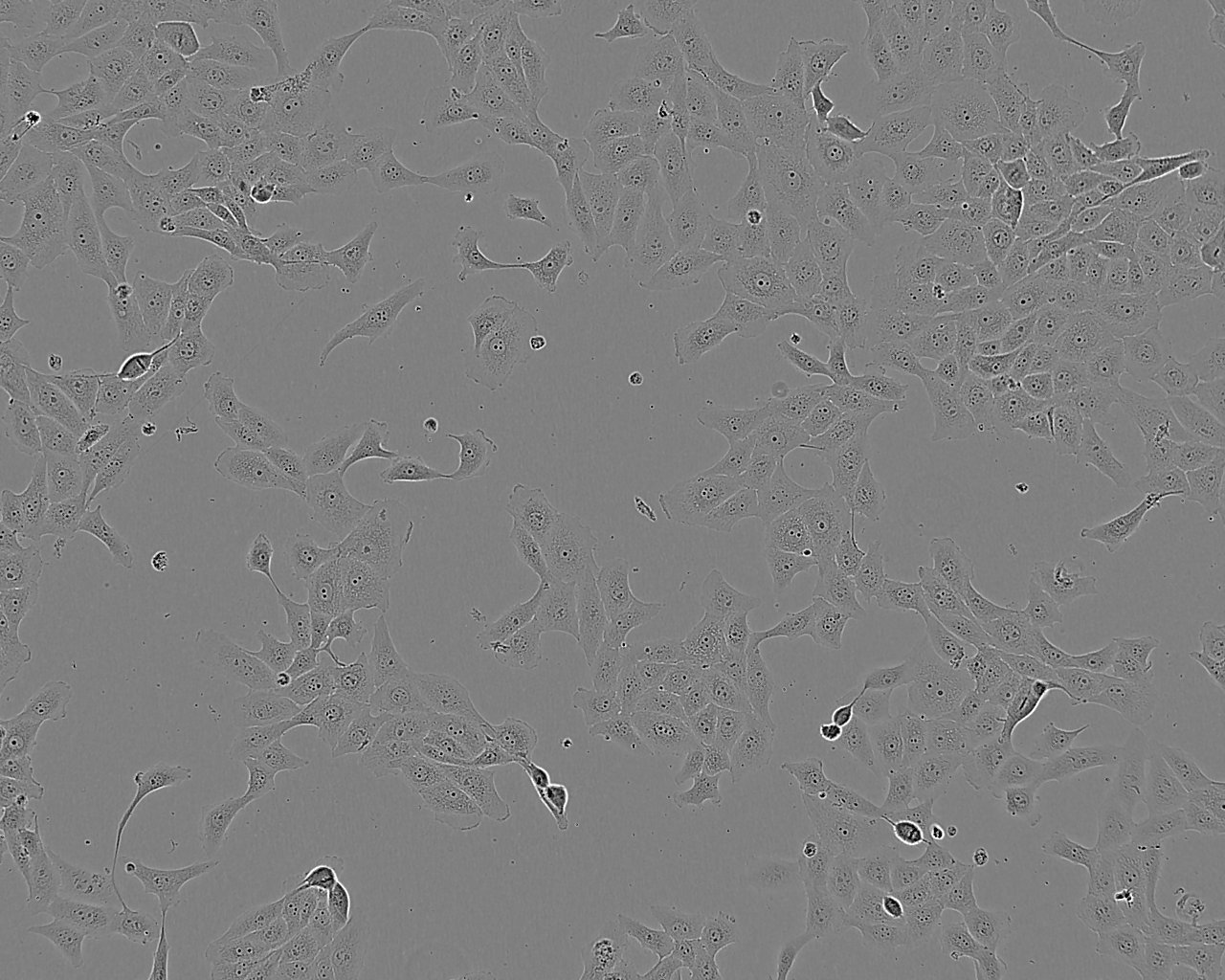 CAL-12T cell line人肺癌细胞系