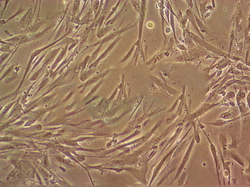 MOVAS-1 cell line小鼠主动脉平滑肌细胞系