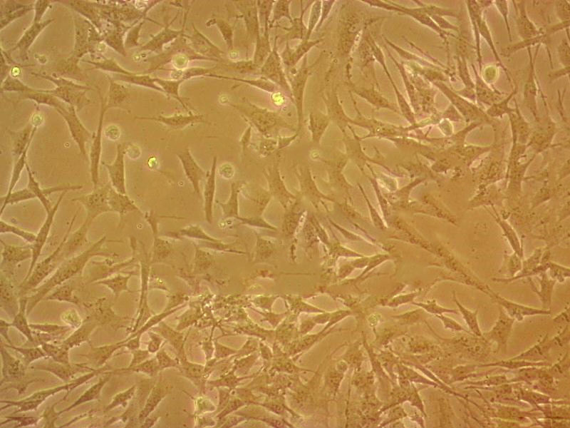 CCD-18Co cell line正常人结肠成纤维细胞系