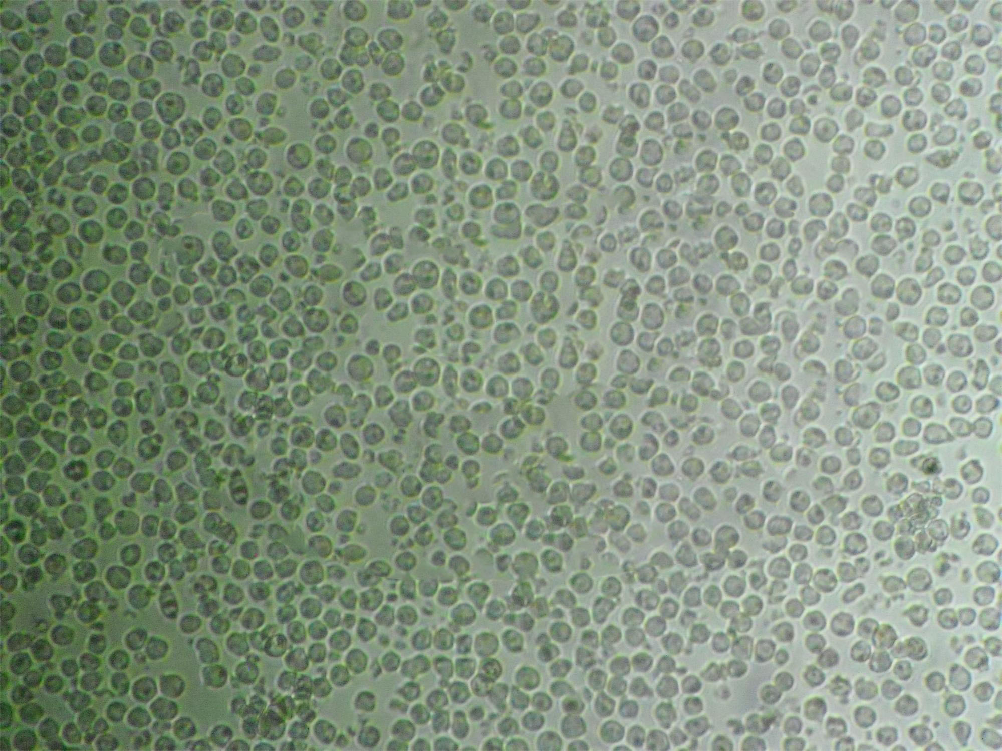 CEM/C1 cell line人急性淋巴细胞白血病细胞系